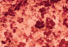 “고지혈증인데 간식은 포기 못해요”… ‘기름진 입’ 대신 ‘지방 똑똑하게 먹기’ 루틴 a bunch of red flowers on a white background